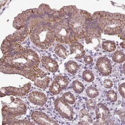 ALDH2 Antibody, Novus Biologicals 0.1 mL | Buy Online | Novus Biologicals | Fisher Scientific