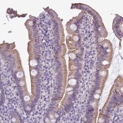 ALDH2 Antibody, Novus Biologicals 0.1 mL | Buy Online | Novus Biologicals | Fisher Scientific