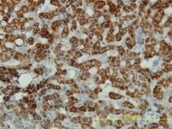 ALDH4A1 Antibody (1A12-A5), Novus Biologicals 0.1 mg | Buy Online | Novus Biologicals | Fisher Scientific