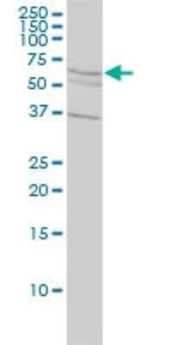 ALDH4A1 Antibody (1A12-A5), Novus Biologicals 0.1 mg | Buy Online | Novus Biologicals | Fisher Scientific