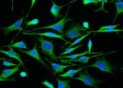 ALDH7A1 Rabbit anti-Human, Clone: 101, Novus Biologicals:Antibodies:Primary