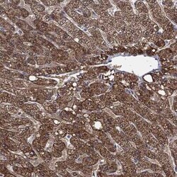 ALDH7A1 Rabbit anti-Human, Polyclonal, Novus Biologicals 100 &mu;g; Unconjugated:Antibodies,