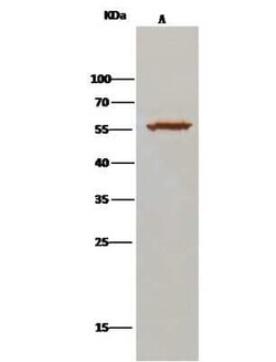 ALDH7A1 Antibody, Novus Biologicals 50 &mu;g | Buy Online | Novus Biologicals | Fisher Scientific