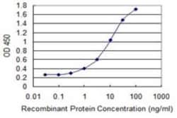 ALDH9A1 Antibody (3C6), Novus Biologicals 0.1 mg | Buy Online | Novus Biologicals | Fisher Scientific