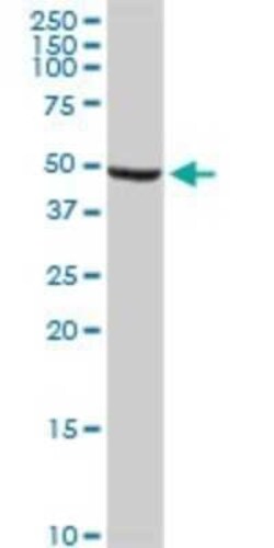ALDH9A1 Antibody (3C6), Novus Biologicals 0.1 mg | Buy Online | Novus Biologicals | Fisher Scientific