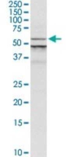 ALG1 Antibody, Novus Biologicals 0.1 mg | Buy Online | Novus Biologicals | Fisher Scientific