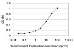 ALG12 Antibody (5E3), Novus Biologicals 0.1 mg | Buy Online | Novus Biologicals | Fisher Scientific