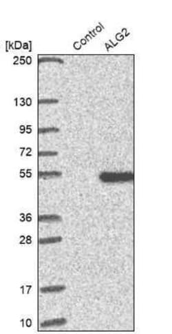 ALG2 Antibody, Novus Biologicals 25 &mu;L; Unconjugated:Anticorps, Polyclonal