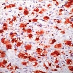 ALK/CD246 Antibody (5A4), Novus Biologicals 0.25 mL; Unconjugated:Antibodies,