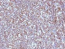 ALK/CD246 Antibody (ALK/1504) - Azide and BSA Free, Novus Biologicals 100