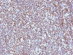 ALK/CD246 Mouse anti-Human, Clone: ALK/1504, Novus Biologicals:Antibodies:Primary