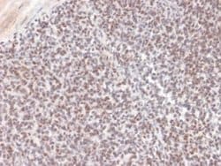 ALK/CD246 Mouse anti-Human, Clone: ALK/1504, Novus Biologicals:Antibodies:Primary
