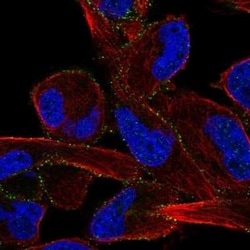 ALK/CD246 Antibody, Novus Biologicals:Antibodies:Primary Antibodies