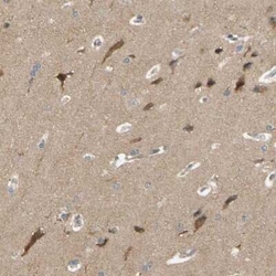 ALK/CD246 Antibody, Novus Biologicals:Antibodies:Primary Antibodies