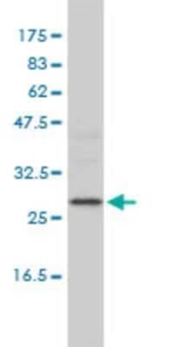 ALKBH3 Antibody (2A5-4F5), Novus Biologicals 0.1 mg | Buy Online | Novus Biologicals | Fisher Scientific