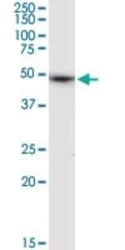 ALLC Antibody, Novus Biologicals 0.1 mg | Buy Online | Novus Biologicals | Fisher Scientific
