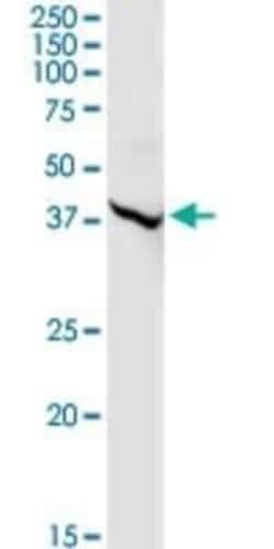 ALLC Antibody, Novus Biologicals 0.1 mg | Buy Online | Novus Biologicals | Fisher Scientific