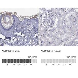 ALOXE3 Antibody, Novus Biologicals:Antibodies:Primary Antibodies