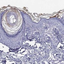 ALOXE3 Antibody, Novus Biologicals:Antibodies:Primary Antibodies