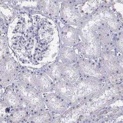 ALOXE3 Antibody, Novus Biologicals:Antibodies:Primary Antibodies