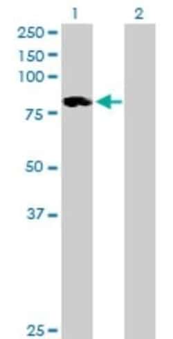 ALOXE3 Antibody, Novus Biologicals 0.05 mg | Buy Online | Novus Biologicals | Fisher Scientific