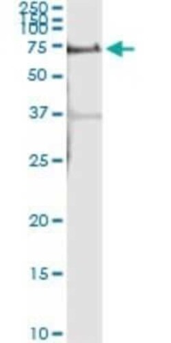 ALPPL2 Antibody (2B3), Novus Biologicals 0.1 mg | Buy Online | Novus Biologicals | Fisher Scientific