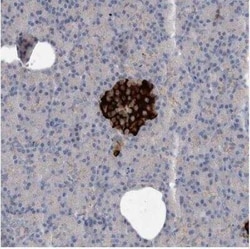 ALS2CR2 Antibody, Novus Biologicals 0.1 mL; Unconjugated:Antibodies, Polyclonal
