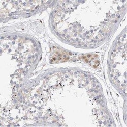 ALS2CR2 Antibody, Novus Biologicals 0.1 mL; Unconjugated:Antibodies, Polyclonal
