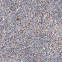 ALS2CR2 Antibody, Novus Biologicals 0.1 mL; Unconjugated:Antibodies, Polyclonal