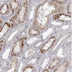 ALS2CR2 Antibody, Novus Biologicals 0.1 mL; Unconjugated:Antibodies, Polyclonal