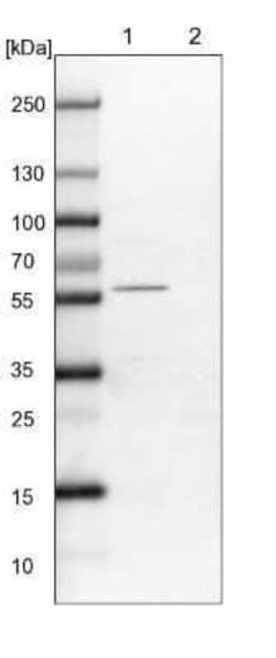 ALS2CR2 Antibody, Novus Biologicals 0.1 mL; Unconjugated:Antibodies, Polyclonal