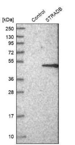 ALS2CR2 Antibody, Novus Biologicals 25 &mu;L | Buy Online | Novus Biologicals | Fisher Scientific