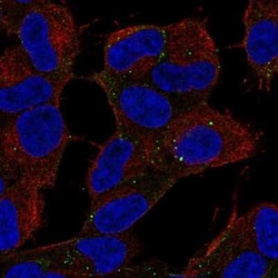 ALS2CR8 Antibody, Novus Biologicals 25ul; Unconjugated:Antibodies, Polyclonal