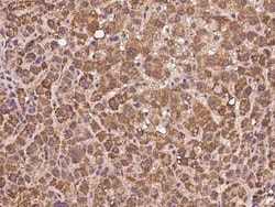 AMD1 Antibody, Novus Biologicals 50 &mu;g | Buy Online | Novus Biologicals | Fisher Scientific