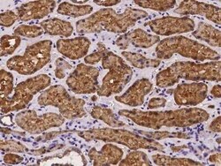 AMDHD1 Antibody, Novus Biologicals:Antibodies:Primary Antibodies