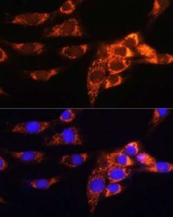 AMPD1 Antibody - BSA Free, Novus Biologicals:Antibodies:Primary Antibodies