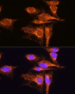 AMPD1 Antibody - BSA Free, Novus Biologicals:Antibodies:Primary Antibodies