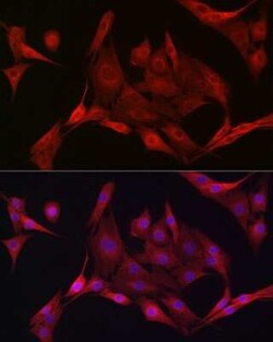 AMPK alpha 1/2 Antibody - Azide and BSA Free, Novus Biologicals 100 &mu;g | Buy Online | Novus Biologicals | Fisher Scientific