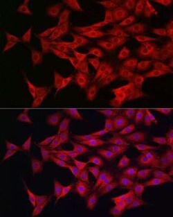 AMPK alpha 1/2 Antibody - Azide and BSA Free, Novus Biologicals 100 &mu;g | Buy Online | Novus Biologicals | Fisher Scientific