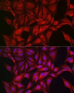 AMPK alpha 1/2 Antibody - Azide and BSA Free, Novus Biologicals 100 &mu;g | Buy Online | Novus Biologicals | Fisher Scientific