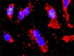 AMPK alpha 2 Antibody (1G8), Novus Biologicals 0.1 mg | Buy Online | Novus Biologicals | Fisher Scientific