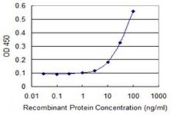 AMPK beta 1 Antibody (1D3), Novus Biologicals 0.1 mg | Buy Online | Novus Biologicals | Fisher Scientific