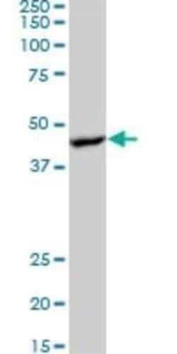 AMPK beta 1 Antibody (1D3), Novus Biologicals 0.1 mg | Buy Online | Novus Biologicals | Fisher Scientific