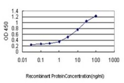 AMPK beta 1 Antibody (2C3), Novus Biologicals 0.1 mg | Buy Online | Novus Biologicals | Fisher Scientific