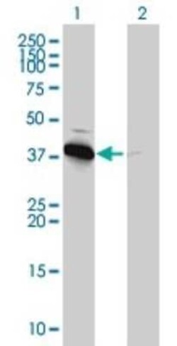 AMPK beta 1 Antibody (3H12-1A10), Novus Biologicals 0.1 mg, Unconjugated:Antikörper