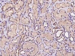 AMSH/STAMBP Antibody, Novus Biologicals 100 &mu;g, Unconjugated:Antibodies,
