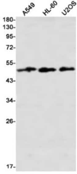 AMSH/STAMBP Antibody (S07-6D1), Novus Biologicals 100 &mu;g; Unconjugated:Antibodies,