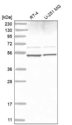 AMSH/STAMBP Antibody, Novus Biologicals:Antibodies:Primary Antibodies