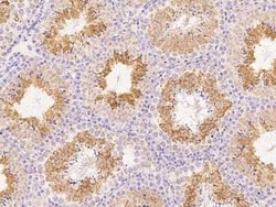 ANGEL1 Antibody, Novus Biologicals 50 &mu;g; Unconjugated:Antibodies, Polyclonal