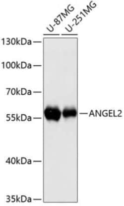 ANGEL2 Antibody - Azide and BSA Free, Novus Biologicals:Antibodies:Primary